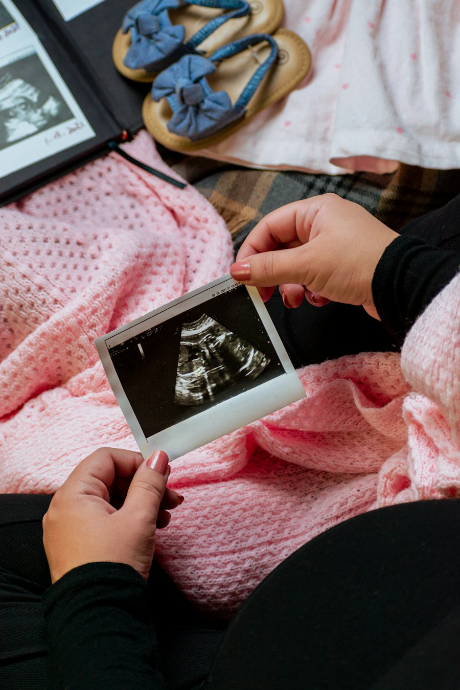 Mujer embarazada sosteniendo la imagen de su ultrasonido